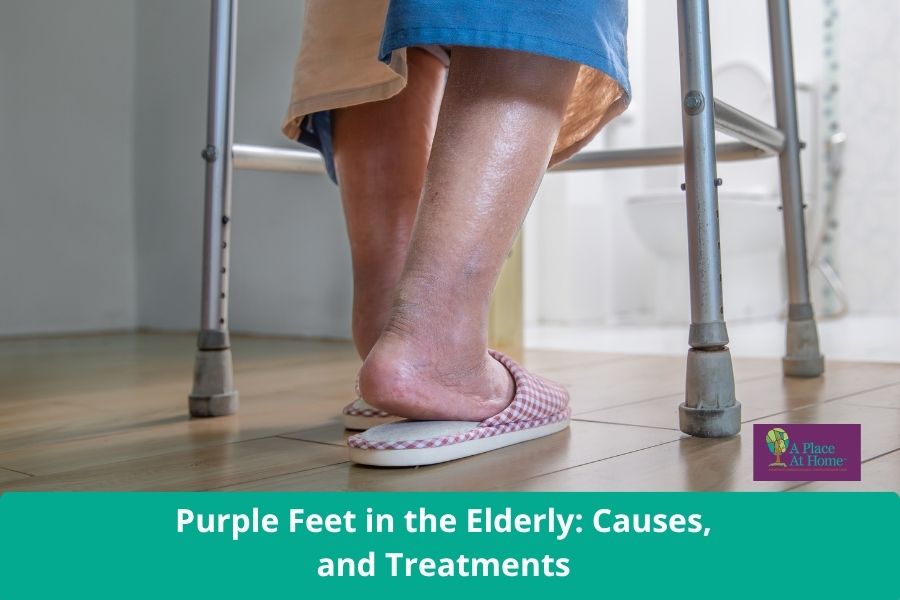 Purple Feet in the Elderly Causes, and Treatments